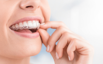 Invisalign Treatment in Coconut Creek, FL